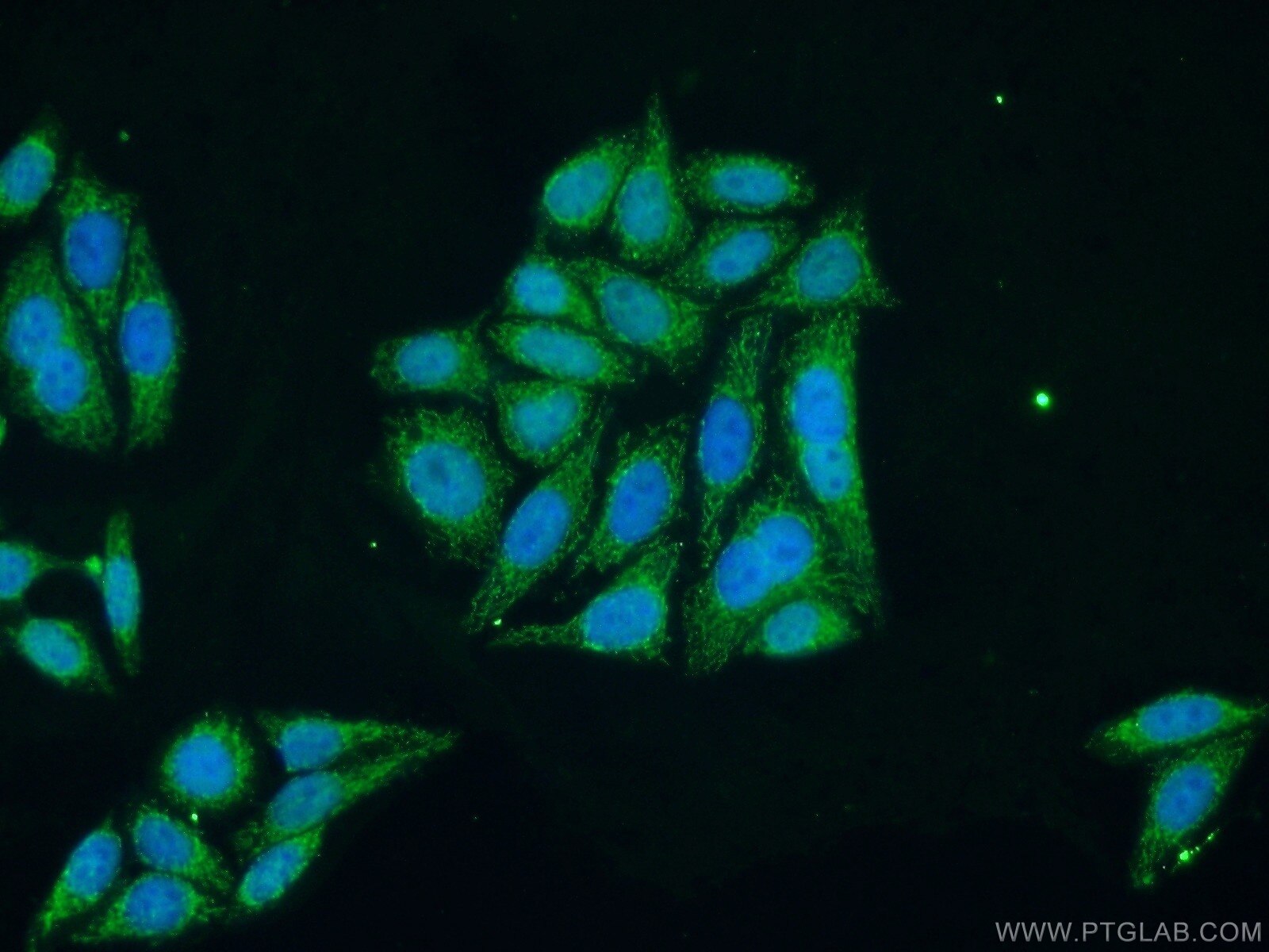 IF Staining of HepG2 using 23996-1-AP