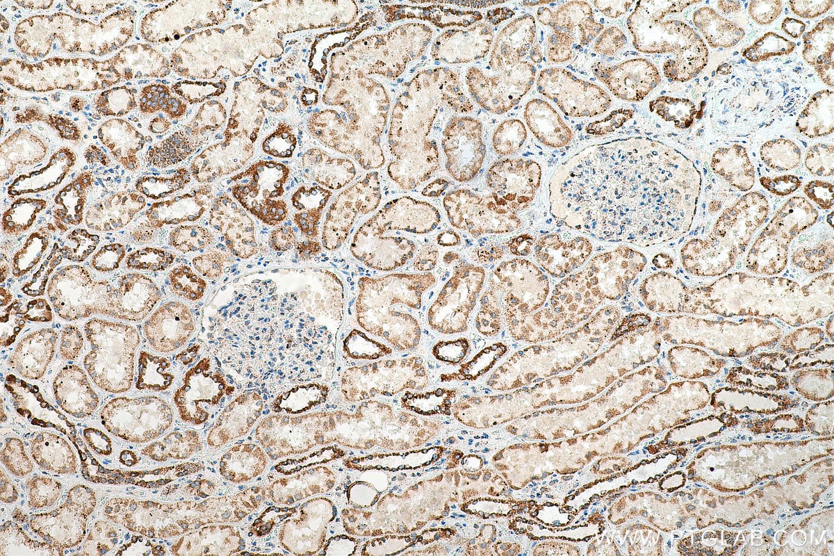 Immunohistochemistry (IHC) staining of human kidney tissue using TFAM Polyclonal antibody (23996-1-AP)