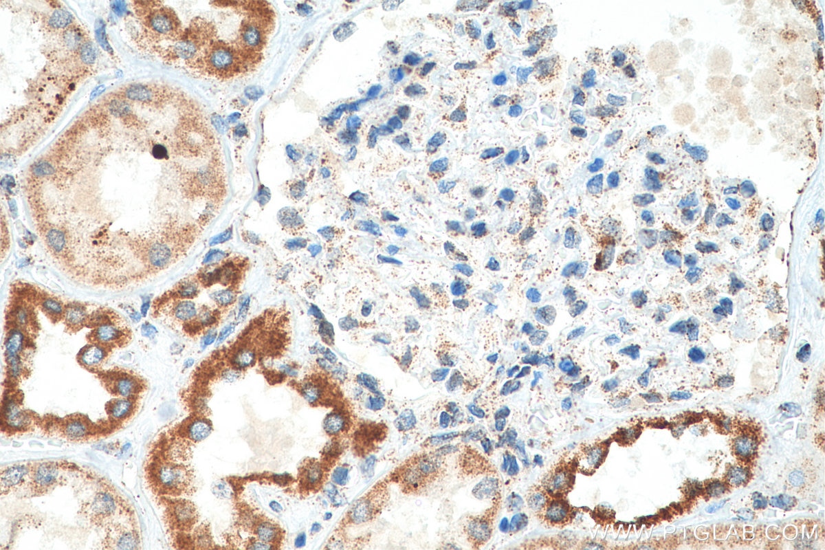 Immunohistochemistry (IHC) staining of human kidney tissue using TFAM Polyclonal antibody (23996-1-AP)