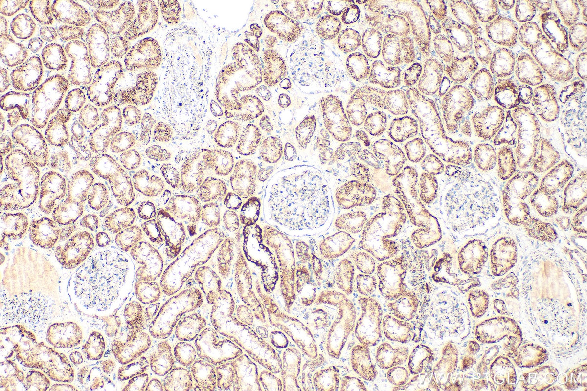 Immunohistochemical analysis of paraffin-embedded human kidney tissue slide using 23996-1-AP (TFAM antibody) at dilution of 1:400 (under 10x lens). Heat mediated antigen retrieval with Tris-EDTA buffer (pH 9.0). Immunohistochemistry (IHC) staining of human kidney tissue using TFAM Polyclonal antibody (23996-1-AP)