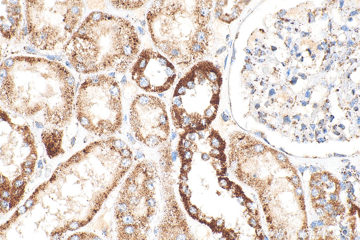 Immunohistochemical analysis of paraffin-embedded human kidney tissue slide using 23996-1-AP (TFAM antibody) at dilution of 1:400 (under 40x lens). Heat mediated antigen retrieval with Tris-EDTA buffer (pH 9.0). Immunohistochemistry (IHC) staining of human kidney tissue using TFAM Polyclonal antibody (23996-1-AP)