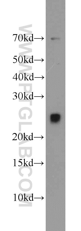 Western Blot (WB) analysis of MCF-7 cells using TFAM Polyclonal antibody (23996-1-AP)