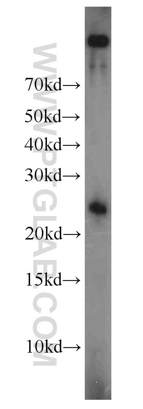 Western Blot (WB) analysis of Jurkat cells using TFAM Polyclonal antibody (23996-1-AP)