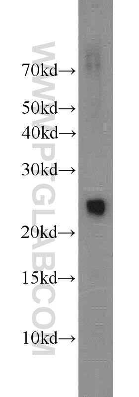 Western Blot (WB) analysis of A431 cells using TFAM Polyclonal antibody (23996-1-AP)