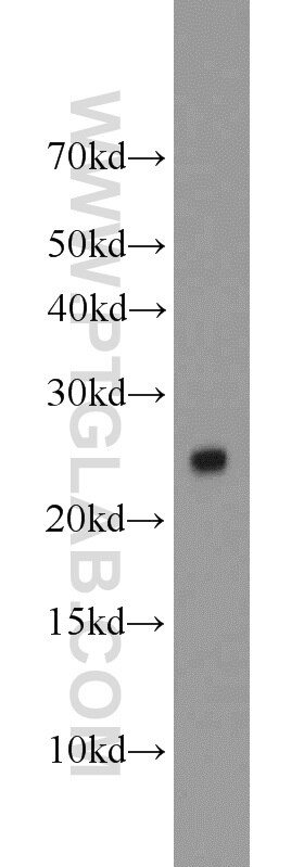 Western Blot (WB) analysis of HEK-293 cells using TFAM Polyclonal antibody (23996-1-AP)