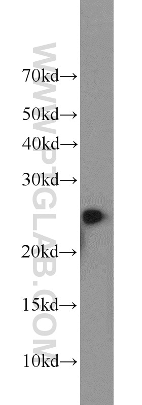 Western Blot (WB) analysis of HL-60 cells using TFAM Polyclonal antibody (23996-1-AP)