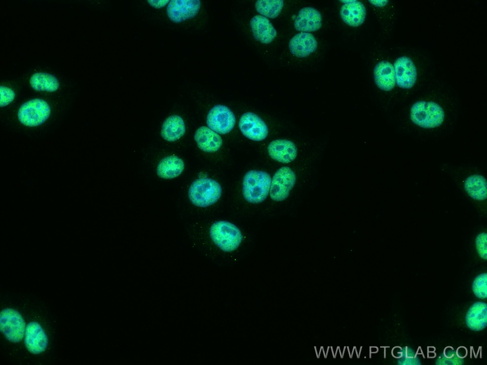 TFAP2A/AP-2