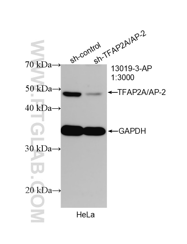 WB analysis of HeLa using 13019-3-AP Western Blot (WB) analysis of HeLa cells using TFAP2A/AP-2 Polyclonal antibody (13019-3-AP)