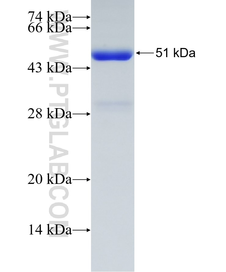 TFAP2A,AP-2 fusion protein Ag4112 SDS-PAGE