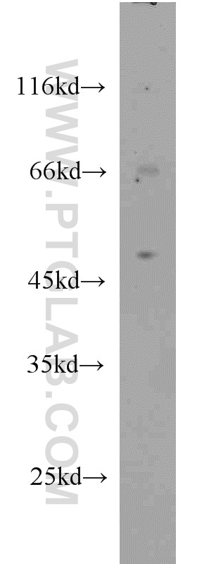 Western Blot (WB) analysis of MCF-7 cells using TFAP2B Polyclonal antibody (13183-1-AP)