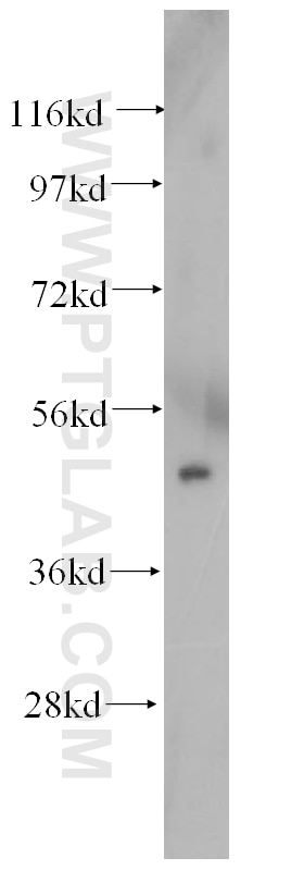 Western Blot (WB) analysis of human placenta tissue using TFAP2C Polyclonal antibody (14572-1-AP)