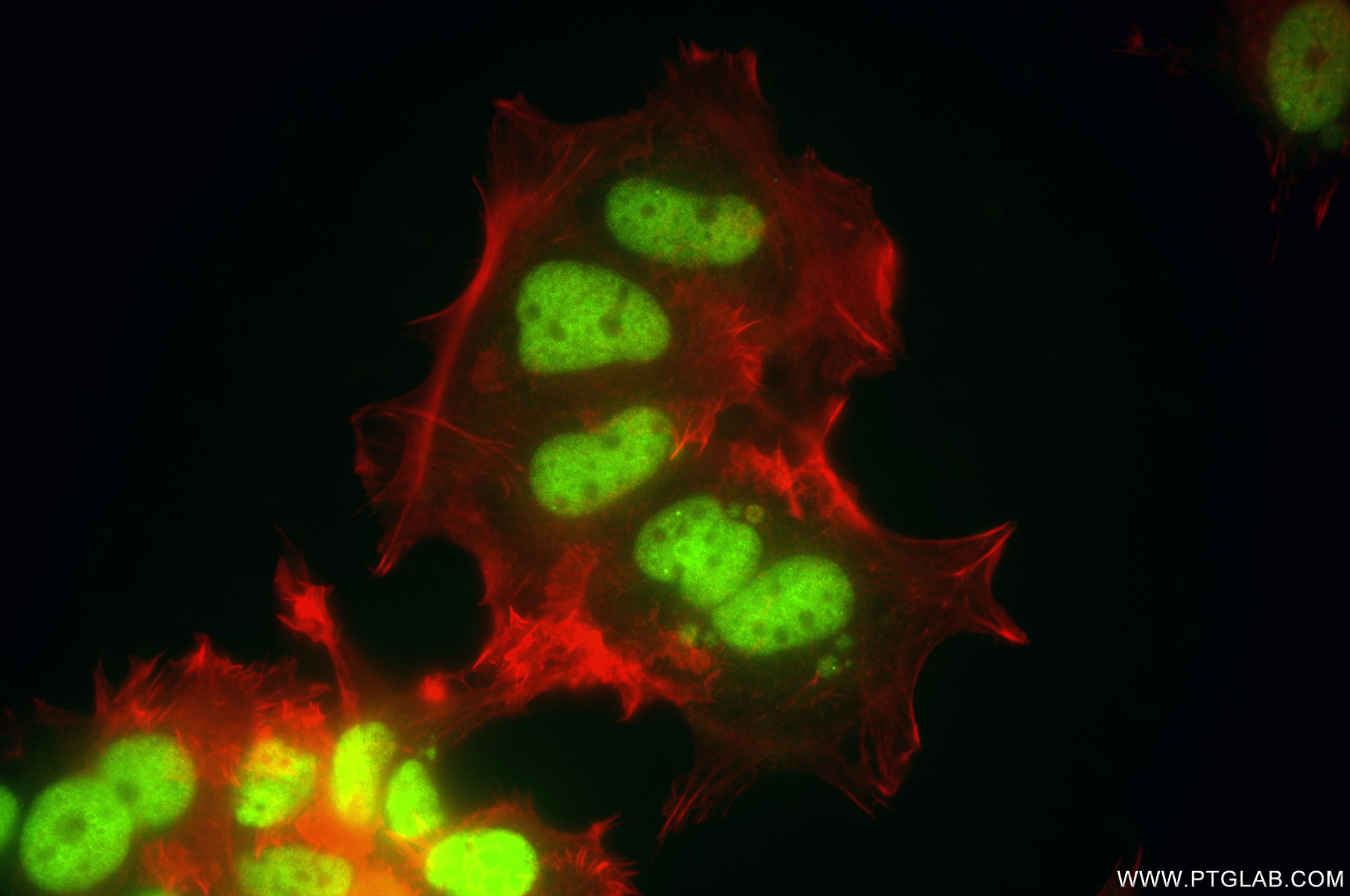 Immunofluorescence (IF) / fluorescent staining of MCF-7 cells using TFAP2C Recombinant antibody (86365-1-RR)