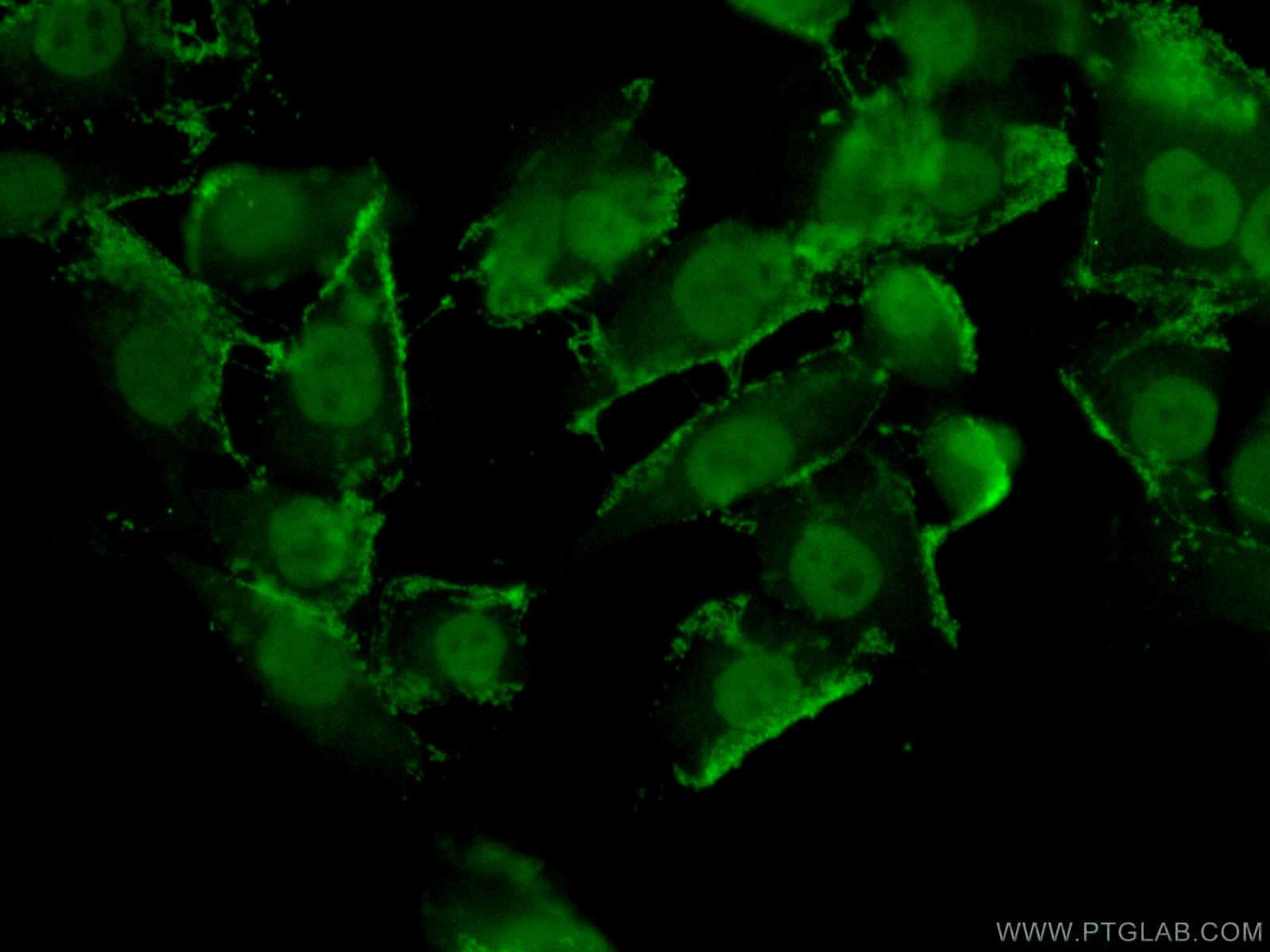 Immunofluorescence (IF) / fluorescent staining of A375 cells using TFAP2E Polyclonal antibody (25829-1-AP)