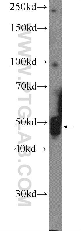 WB analysis of mouse brain using 25829-1-AP