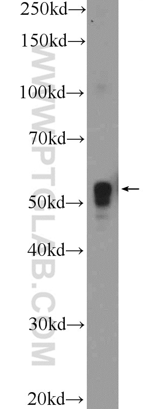 Western Blot (WB) analysis of rat brain tissue using TFAP2E Polyclonal antibody (25829-1-AP)