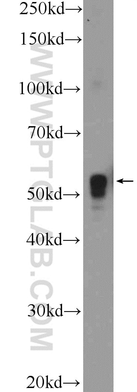 WB analysis of rat brain using 25829-1-AP