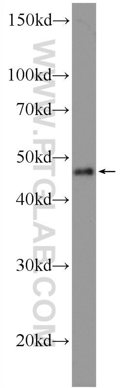 Western Blot (WB) analysis of A375 cells using TFAP2E Polyclonal antibody (25829-1-AP)