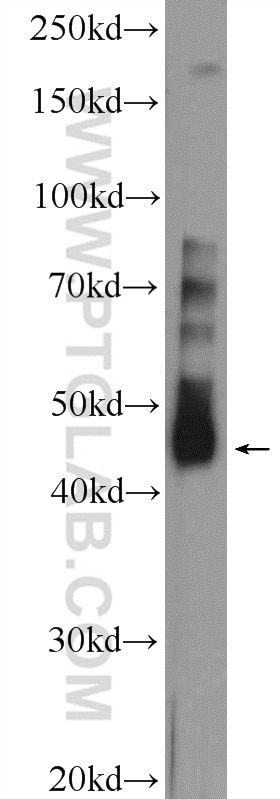 WB analysis of mouse testis using 24411-1-AP