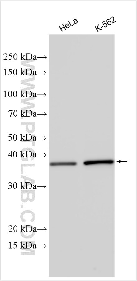 Various lysates were subjected to SDS PAGE followed by western blot with 24411-1-AP (TFB2M antibody) at dilution of 1:5000 incubated at room temperature for 1.5 hours. Western Blot (WB) analysis of various lysates using TFB2M Polyclonal antibody (24411-1-AP)