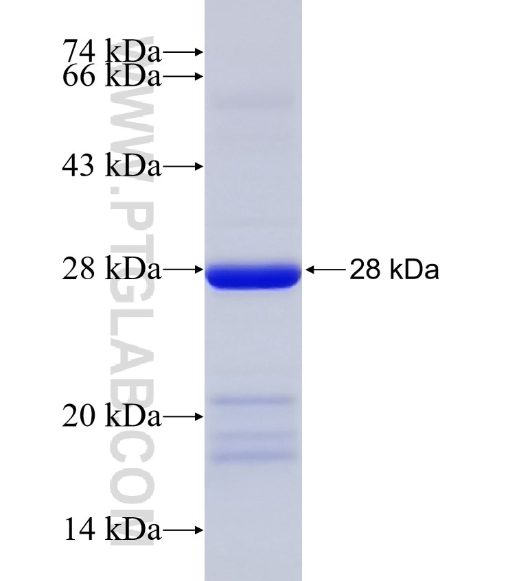 TFB2M fusion protein Ag19687 SDS-PAGE