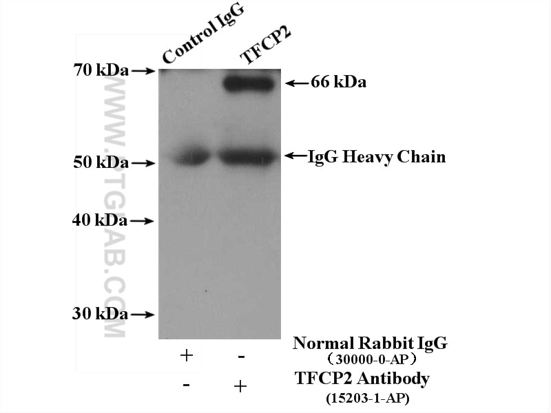 Immunoprecipitation (IP) experiment of mouse spleen tissue using TFCP2 Polyclonal antibody (15203-1-AP)
