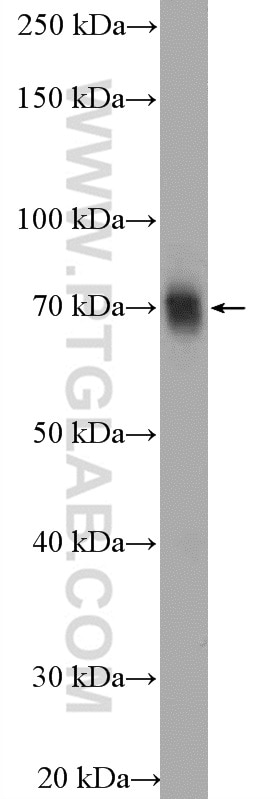 Western Blot (WB) analysis of mouse spleen tissue using TFCP2 Polyclonal antibody (15203-1-AP)