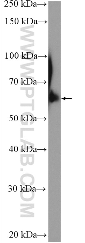 Western Blot (WB) analysis of rat brain tissue using TFCP2 Polyclonal antibody (15203-1-AP)