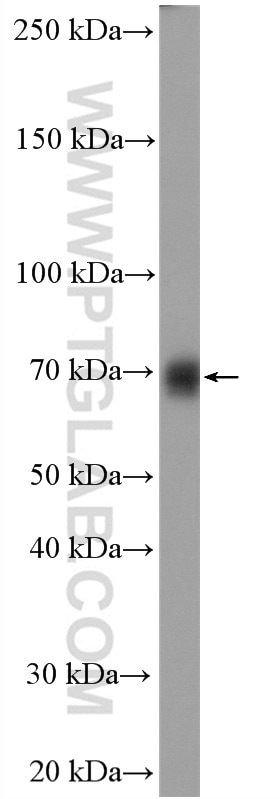 Western Blot (WB) analysis of rat spleen tissue using TFCP2 Polyclonal antibody (15203-1-AP)