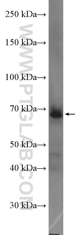 Western Blot (WB) analysis of mouse kidney tissue using TFCP2 Polyclonal antibody (15203-1-AP)