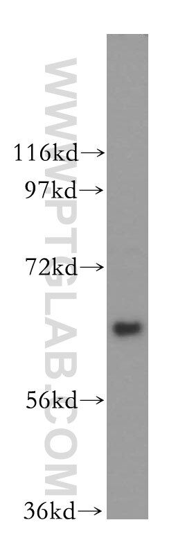 Western Blot (WB) analysis of K-562 cells using TFCP2 Polyclonal antibody (15203-1-AP)