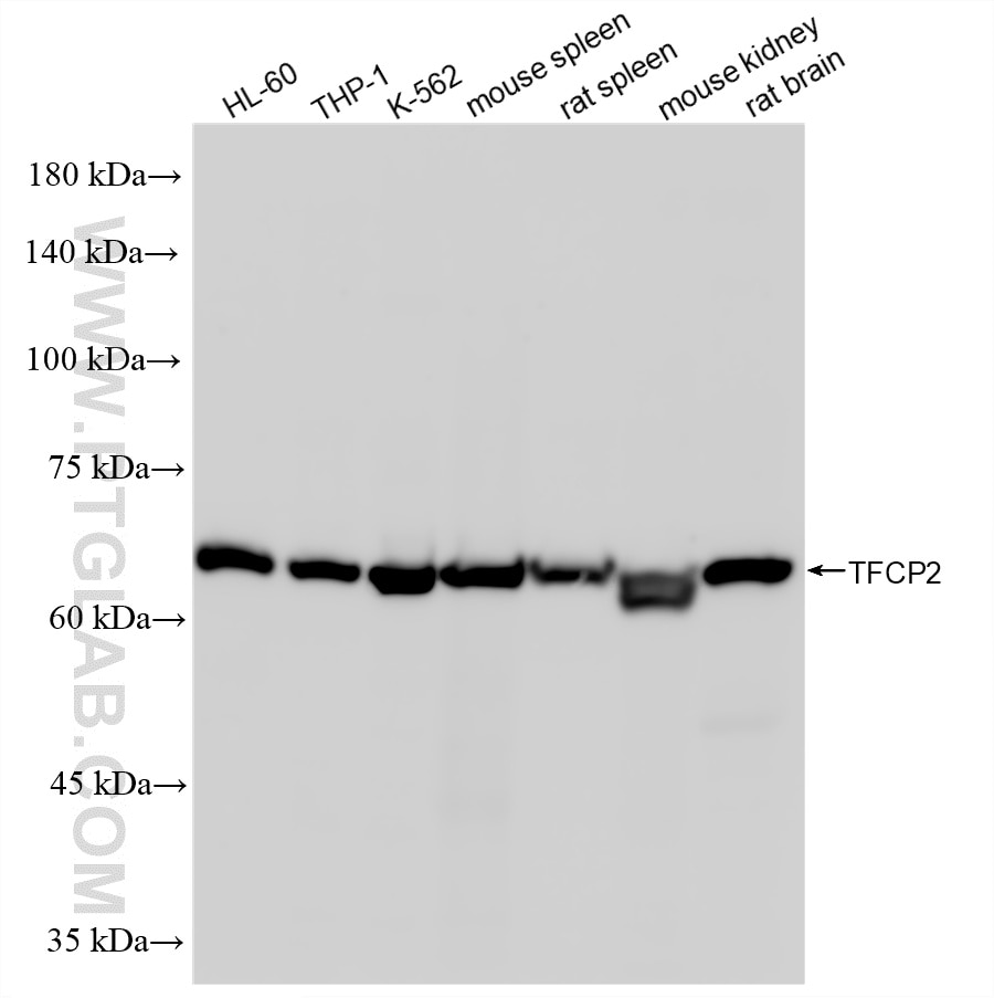 Western Blot (WB) analysis of various lysates using TFCP2 Recombinant monoclonal antibody (86807-1-RR)