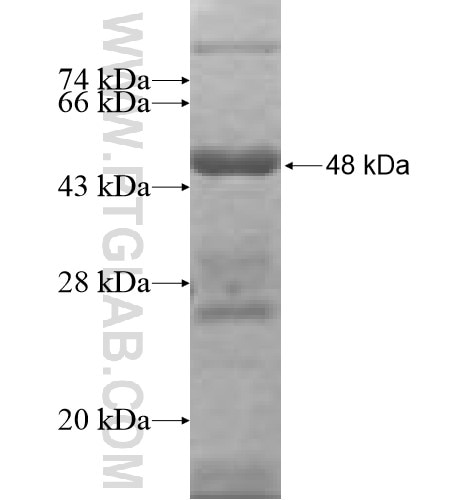 TFCP2 fusion protein Ag7521 SDS-PAGE