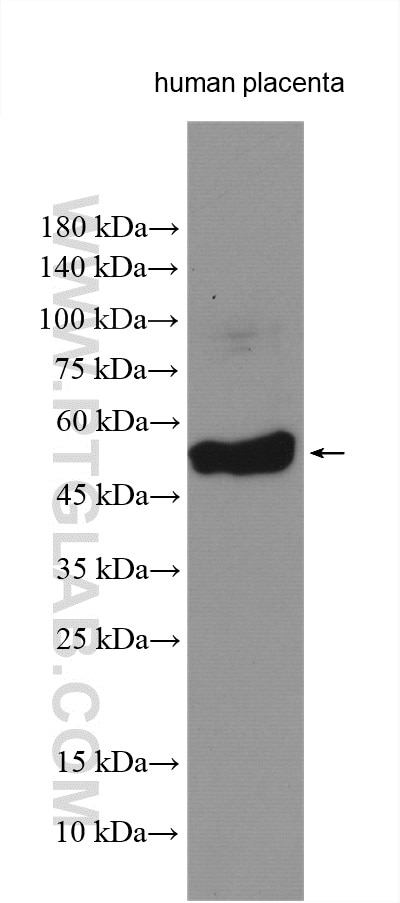 Western Blot (WB) analysis of various lysates using TFCP2L1 Polyclonal antibody (14248-1-AP)