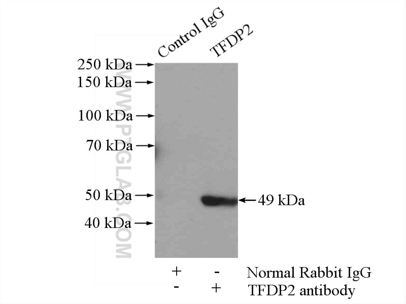Immunoprecipitation (IP) experiment of SH-SY5Y cells using TFDP2 Polyclonal antibody (11500-1-AP)