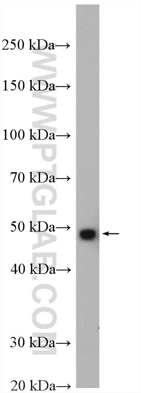 WB analysis of mouse heart using 11500-1-AP