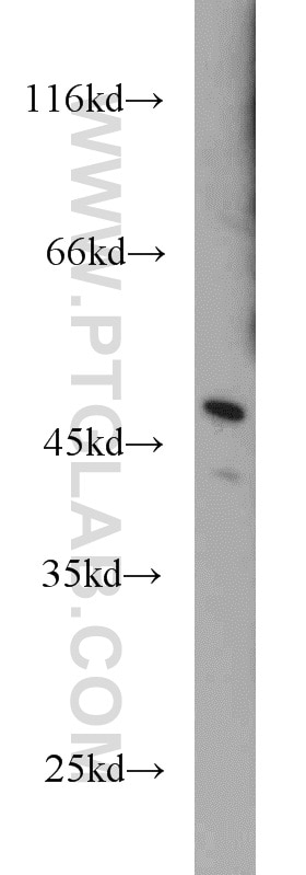 Western Blot (WB) analysis of human brain tissue using TFDP2 Polyclonal antibody (11500-1-AP)