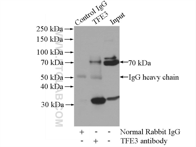 IP experiment of K-562 using 14480-1-AP