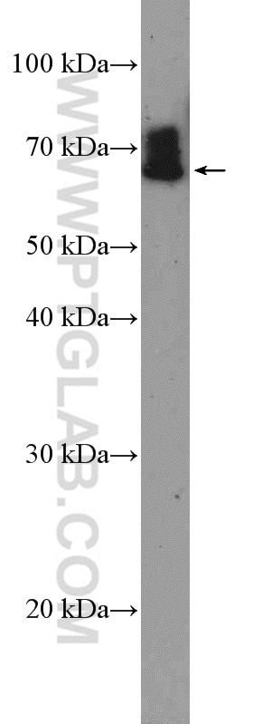 Western Blot (WB) analysis of mouse spleen tissue using TFE3 Polyclonal antibody (14480-1-AP)