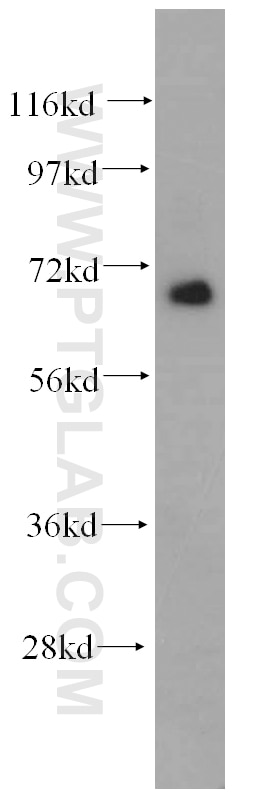 Western Blot (WB) analysis of K-562 cells using TFE3 Polyclonal antibody (14480-1-AP)