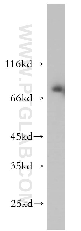 Western Blot (WB) analysis of human brain tissue using TFE3 Polyclonal antibody (14480-1-AP)