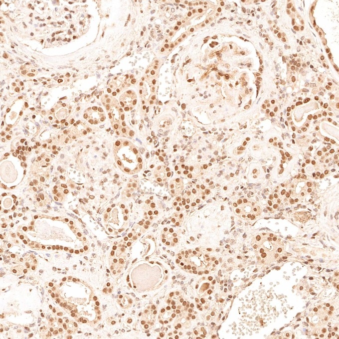 Immunohistochemistry (IHC) staining of human kidney tissue using TFE3 Monoclonal antibody (67319-1-Ig)