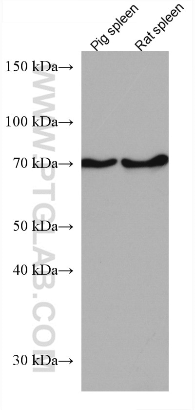 Western Blot (WB) analysis of various lysates using TFE3 Monoclonal antibody (67319-1-Ig)