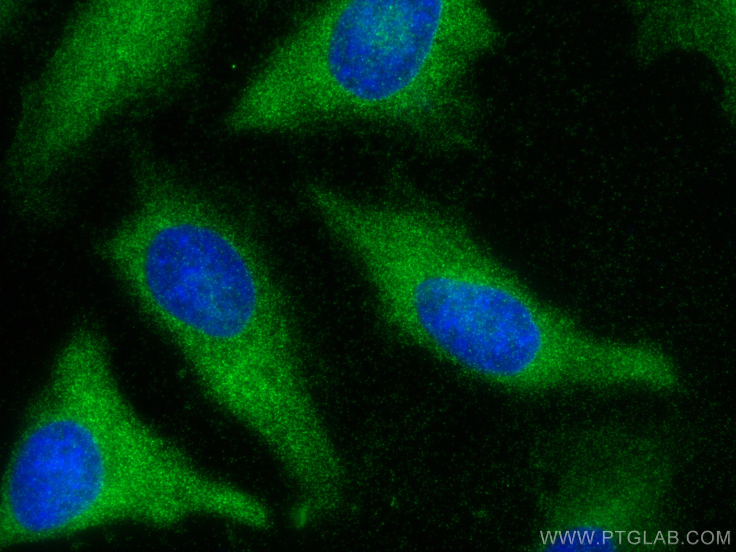 IF Staining of HeLa using 13372-1-AP