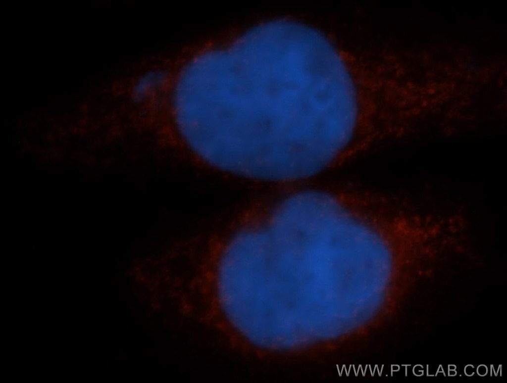 Immunofluorescence (IF) / fluorescent staining of HeLa cells using TFEB Polyclonal antibody (13372-1-AP)