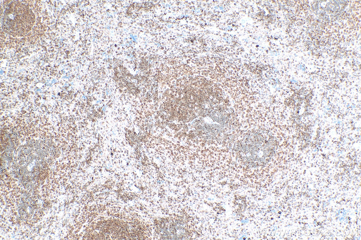 Immunohistochemistry (IHC) staining of rat spleen tissue using TFEB Polyclonal antibody (13372-1-AP)