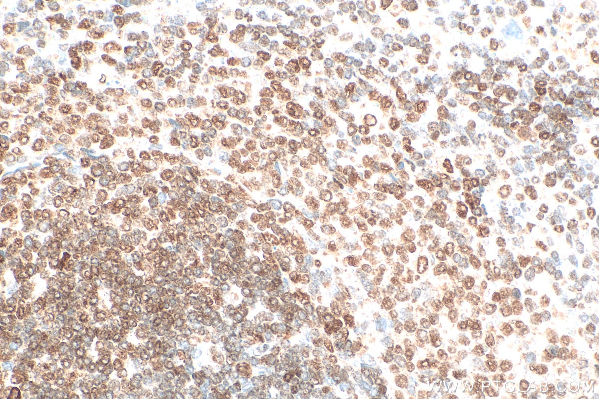 Immunohistochemistry (IHC) staining of rat spleen tissue using TFEB Polyclonal antibody (13372-1-AP)