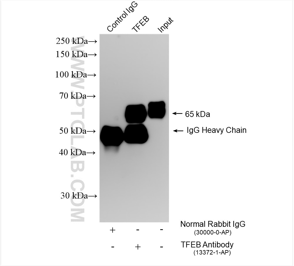 Immunoprecipitation (IP) experiment of Raji cells using human TFEB Polyclonal antibody (13372-1-AP)