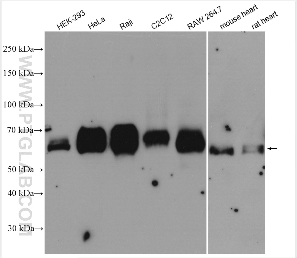 Western Blot (WB) analysis of various lysates using TFEB Polyclonal antibody (13372-1-AP)
