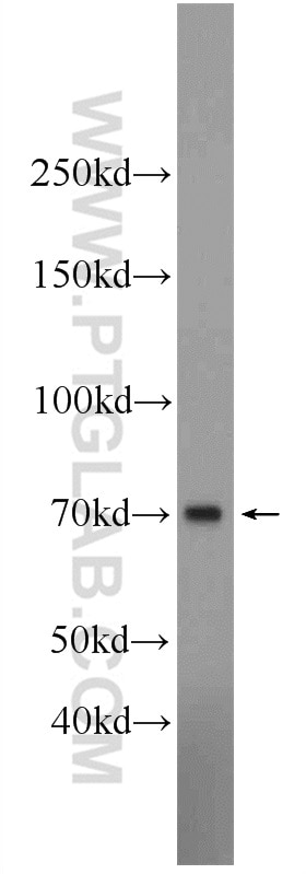 Western Blot (WB) analysis of rat brain tissue using TFEB Polyclonal antibody (13372-1-AP)