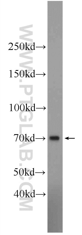 WB analysis of rat brain using 13372-1-AP